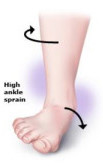high-ankle-sprain-300x179 2